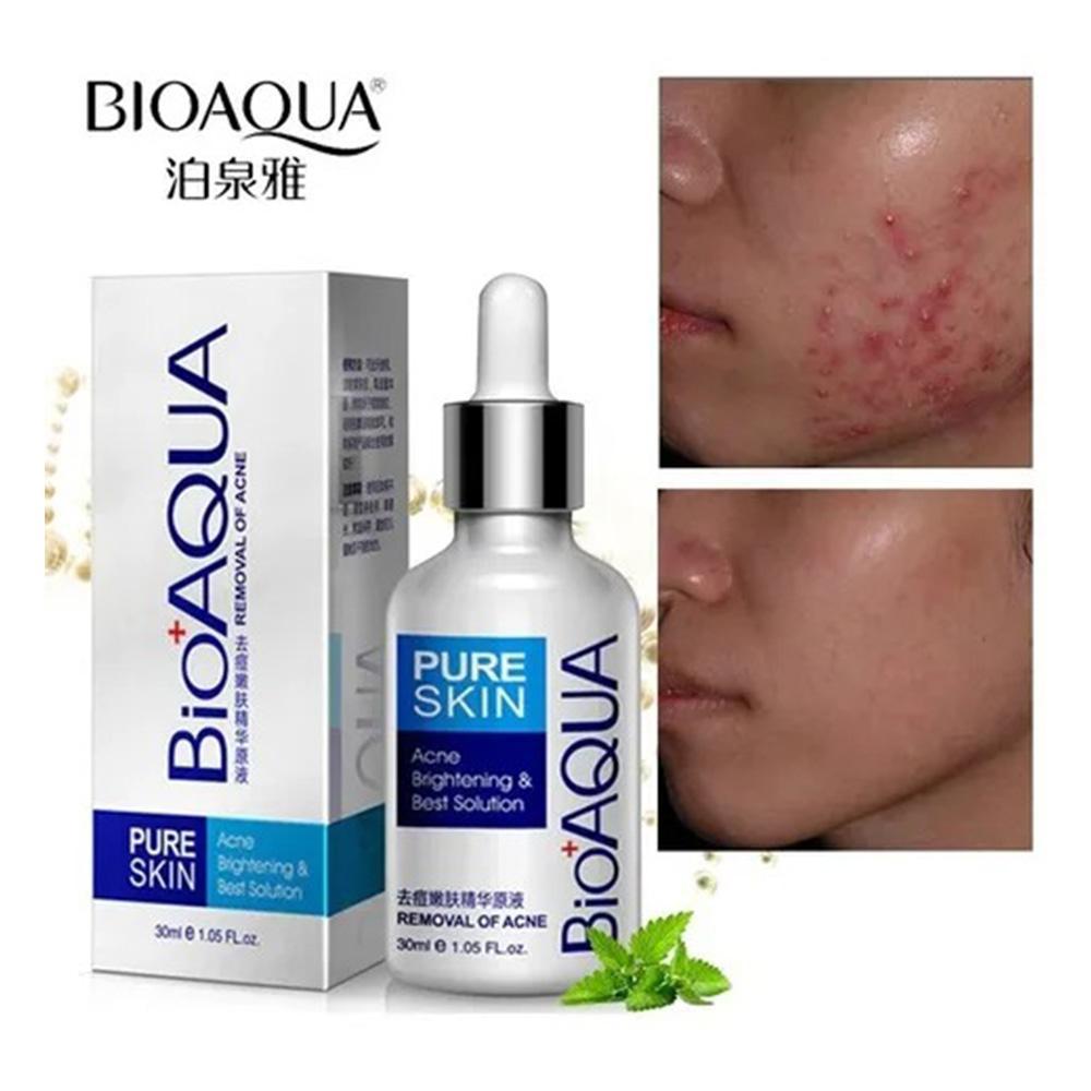 Serum Facial Antiacne Bioaqua – foto 4